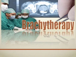 Scar Tissue Brachytherapy Cancer